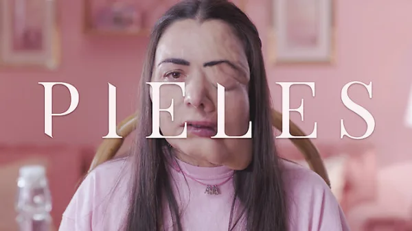 Pieles
