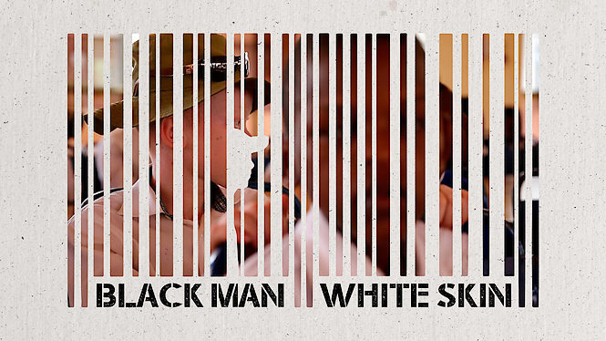 Hombre Negro, Piel Blanca